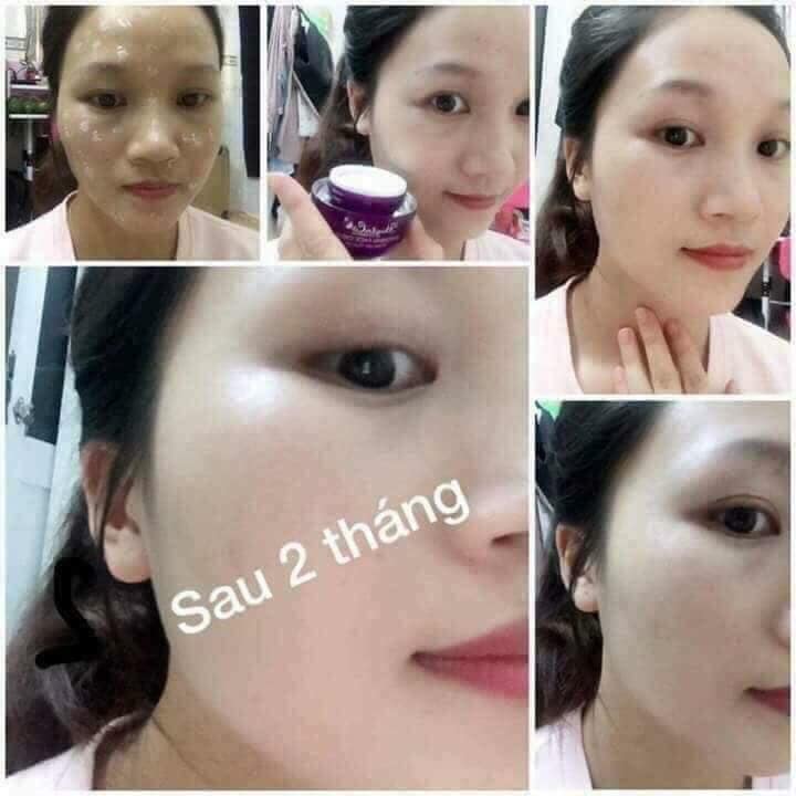 Kem Face tế bào gốc Huyền Cò